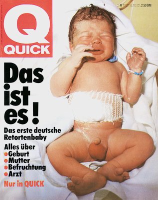 Erstes Retortenbaby Deutschlands, "Quick" vom 22.4.1982 http://www.175jahrefrauenklinik.de/ausstell/index.htm