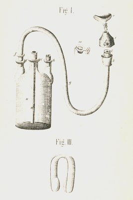 Skizze des Ätherapparates von Johann Ferdinand Heyfelder, 1847, Universitätsbibliothek Erlangen, Signatur N.Med. VI, 45