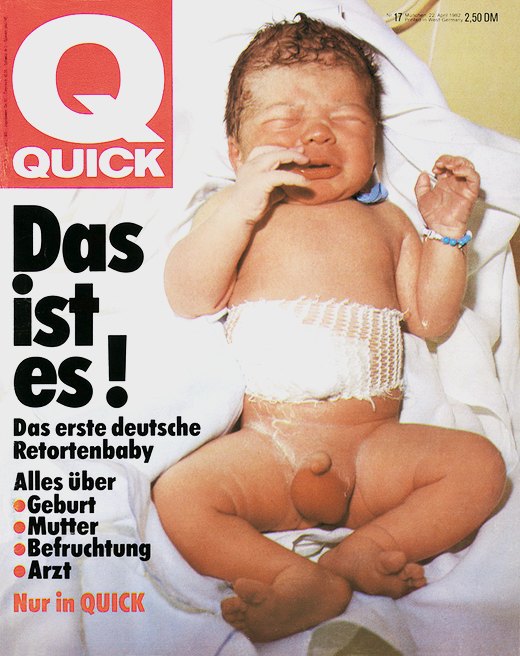 Erstes Retortenbaby Deutschlands, "Quick" vom 22.4.1982
http://www.175jahrefrauenklinik.de/ausstell/index.htm