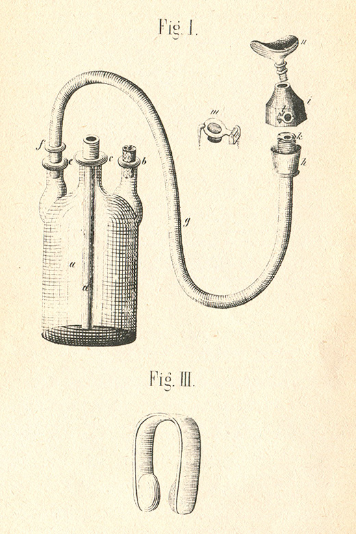 Skizze des Ätherapparates von Johann Ferdinand Heyfelder, 1847, Universitätsbibliothek Erlangen, Signatur N.Med. VI, 45